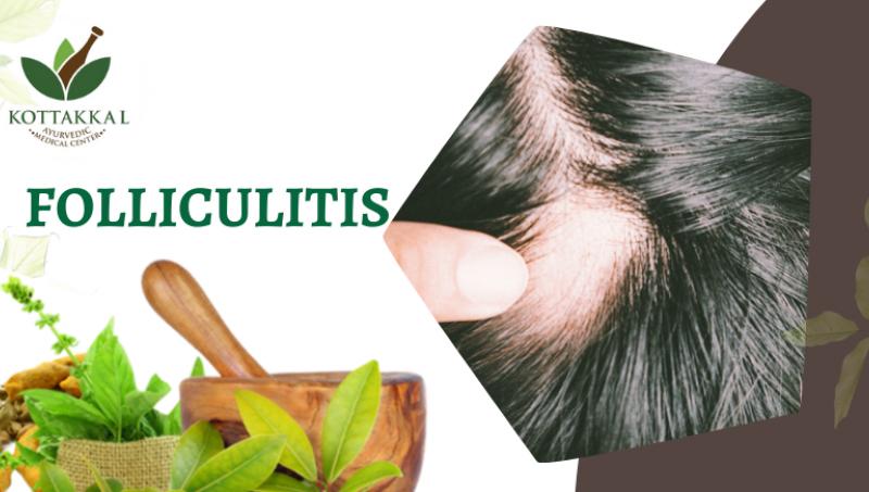 FOLLICULITIS